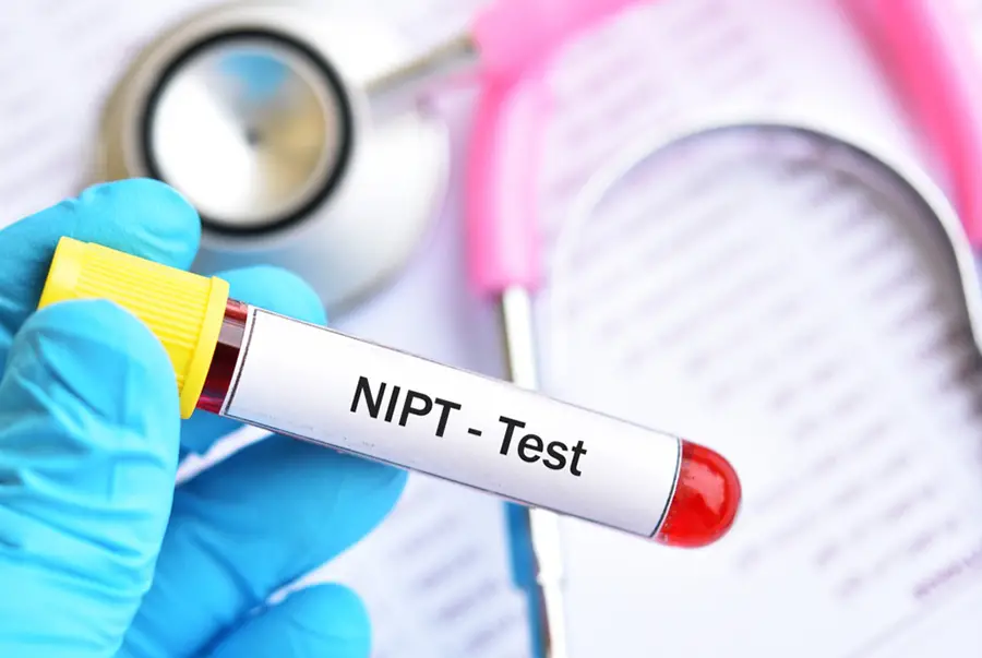 NIPT TESTİ  AYDIN